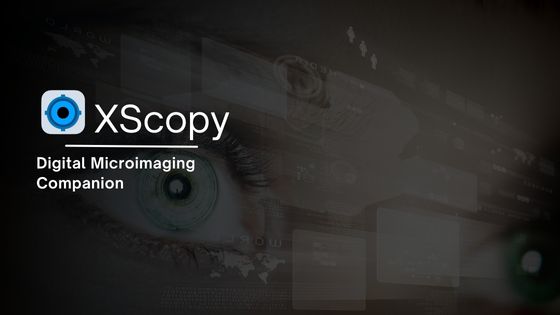 Xscopy Feature